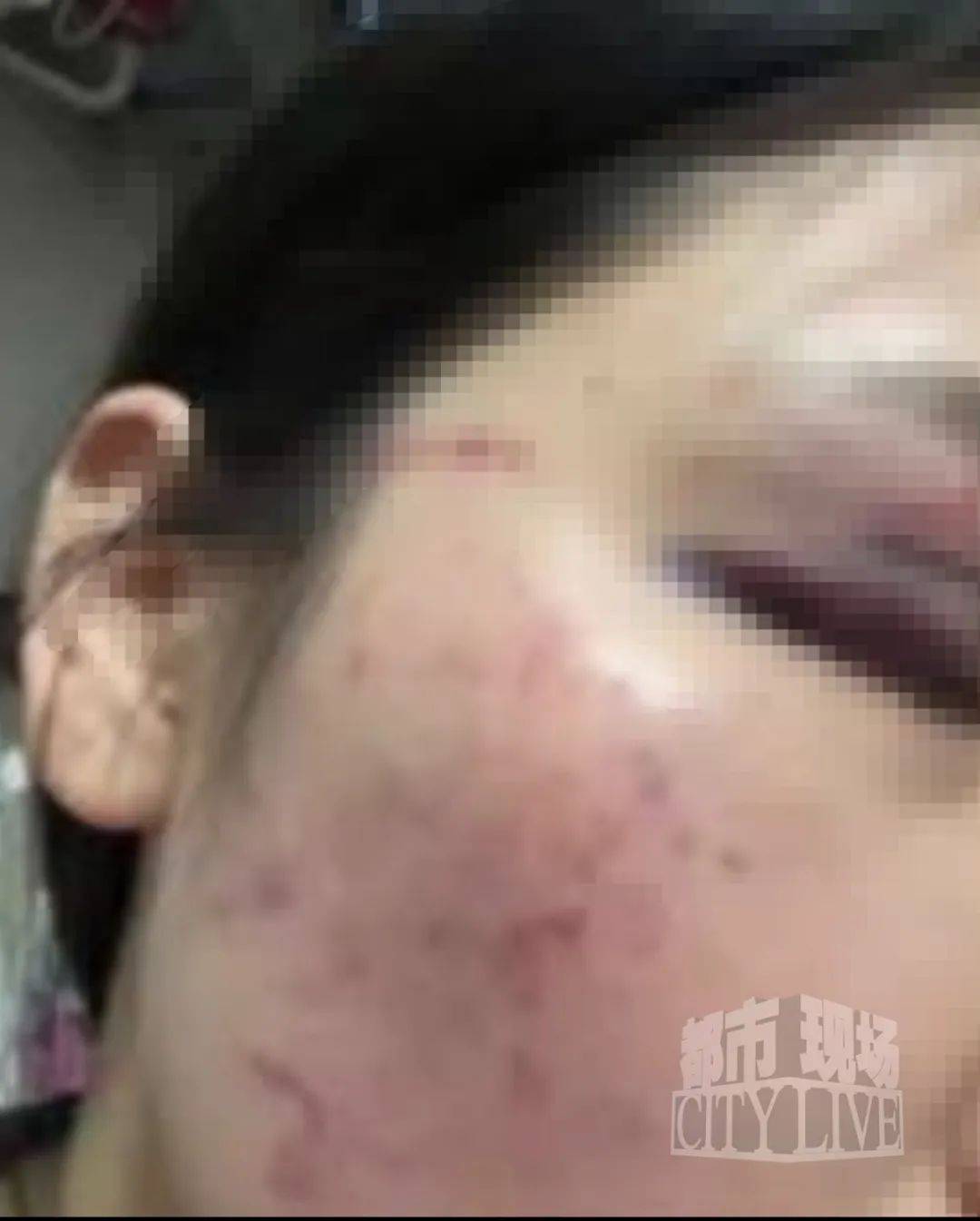 皇冠信用网代理流程_湖南衡阳29岁女子疑被男友施暴后从25楼跳下身亡 男友徐某此前还刺激说：“你放心皇冠信用网代理流程，她不会去死的”