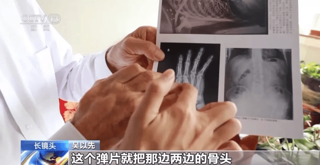 皇冠信用盘可以占几成
_“老先生皇冠信用盘可以占几成
,您把项链取下来再做CT”